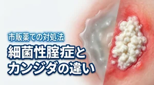 【市販薬で治る？】細菌性腟症とカンジダの違いを理解して正しく対処する方法