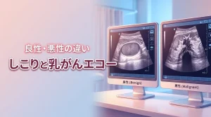 しこりは乳がん？エコーで見える良性と悪性の違いや検査結果の意味を分かりやすく解説