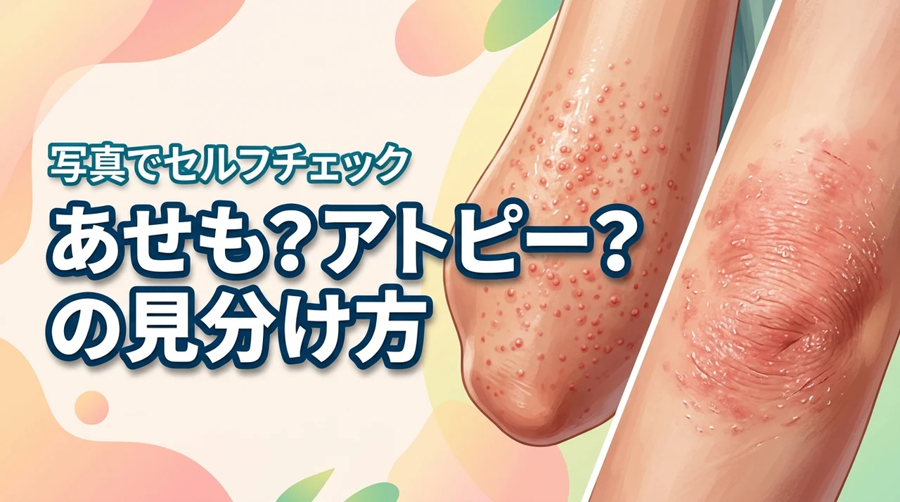そのブツブツはあせも？それともアトピー？違いを写真でセルフチェックしよう