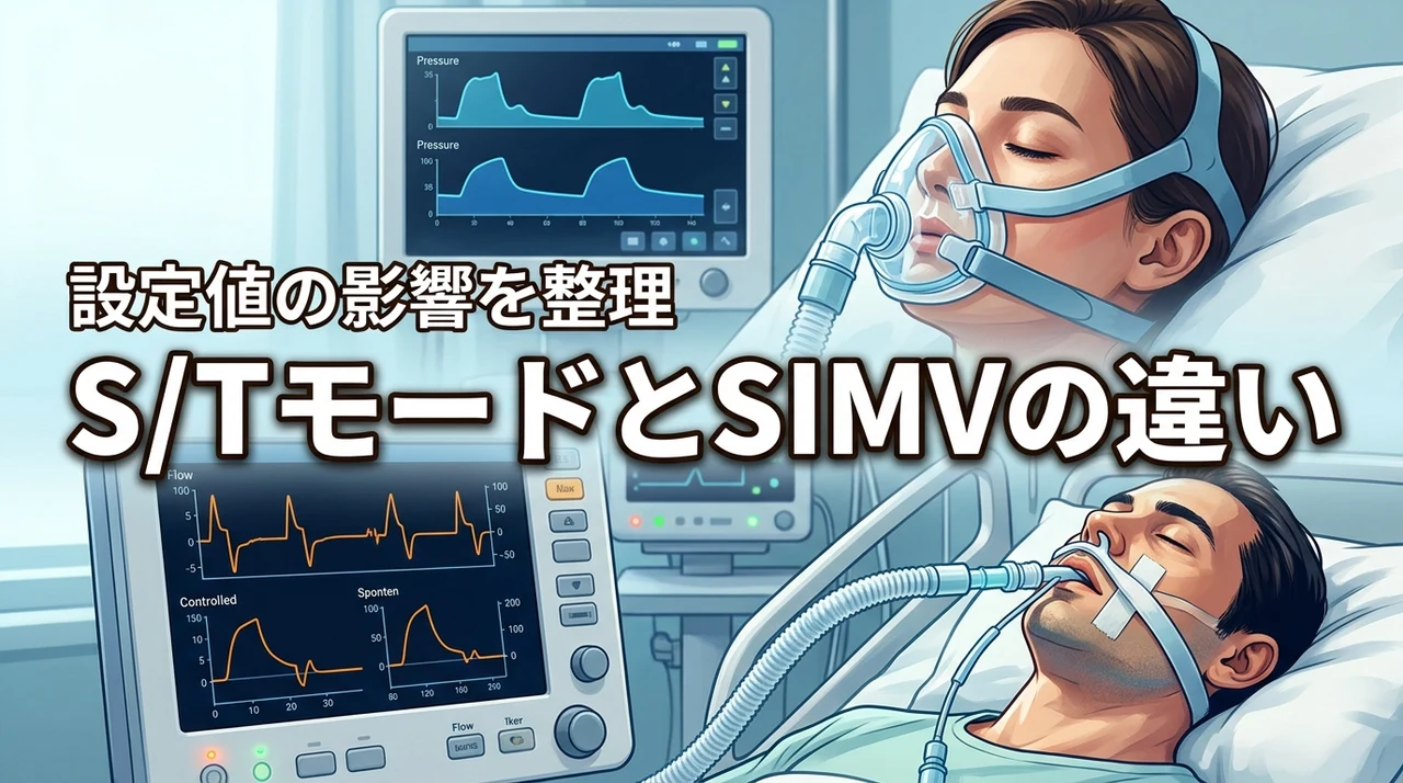s/tモードとsimvの違いで迷っていませんか？設定値が呼吸に与える影響を整理