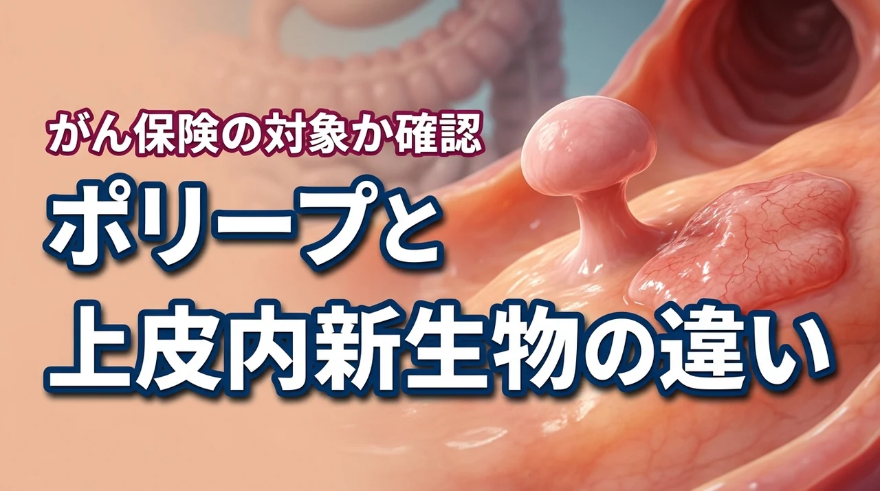 ポリープと上皮内新生物の違いは？がん保険が下りるか不安な人が確認すべき点